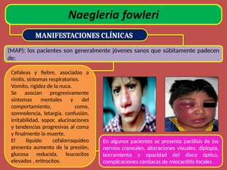 MANIFESTACIONES CLÍNICAS
(MAP): los pacientes son generalmente jóvenes sanos que súbitamente padecen
de:
Cefaleas y fiebre, asociadas a
rinitis, síntomas respiratorios.
Vomito, rigidez de la nuca.
Se asocian progresivamente
síntomas mentales y del
comportamiento, como,
somnolencia, letargia, confusión,
irritabilidad, sopor, alucinaciones
y tendencias progresivas al coma
y finalmente la muerte.
El liquido cefalorraquídeo
presenta aumento de la presión,
glucosa reducida, leucocitos
elevados , eritrocitos.
En algunos pacientes se presenta parálisis de los
nervios craneales, alteraciones visuales, diplopía,
borramiento y opacidad del disco óptico,
complicaciones cardiacas de miocarditis focales .
 