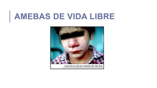 AMEBAS DE VIDA LIBRE