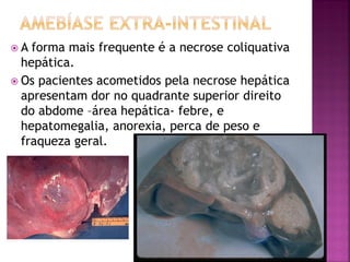 A  forma mais frequente é a necrose coliquativa
  hepática.
 Os pacientes acometidos pela necrose hepática
  apresentam dor no quadrante superior direito
  do abdome –área hepática- febre, e
  hepatomegalia, anorexia, perca de peso e
  fraqueza geral.
 