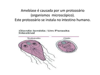 Amebíase é causada por um protozoário
          (organismos microscópico).
Este protozoário se instala no intestino humano.
 