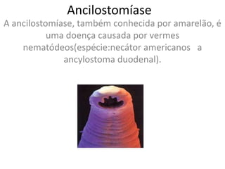 Ancilostomíase
A ancilostomíase, também conhecida por amarelão, é
           uma doença causada por vermes
    nematódeos(espécie:necátor americanos a
              ancylostoma duodenal).
 
