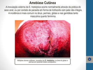 Amebíase Cutânea
Múltiplas úlceras cutâneas, causadas por E. histolytica, na área do glúteo e
períneo em paciente indiano soropositivo.
A inoculação externa da E. histolytica ocorre normalmente através da prática do
sexo anal, ou por contato do parasita em forma de trofozoíto com pele não-íntegra.
A incidência é mais comum no ânus, períneo, glúteo e nas genitálias tanto
masculina quanto feminina.
 