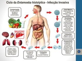Ciclo da Entamoeba histolytica - Infecção Invasiva
Cisto Maduro
Viaja da boca até
o intestino
delgado, onde se
rompe.
Excistação
Um Metacisto
de quatro
núcleos emerge
e se divide três
vezes e cada
núcleo se divide
uma vez,
produzindo oito
trofozoítos.
Trofozoítos
Migram para o
intestino grosso.
Cissiparidade
Trofozoítos se
multiplicam, e
uma parte se
tornará cistos,
enquanto outra
manterá a forma
original e se
alojará no
intestino.
Contaminação
Via oral, através
de água e
alimentos
contaminados.
Órgãos vitais,
como o cérebro,
coração, fígado,
pulmões e rins,
são atingidos.
Trofozoítos
invadem a
mucosa intestinal.
Em seguida,
entram na
corrente
sanguínea do
infectado.
MAIS AFETADO
 
