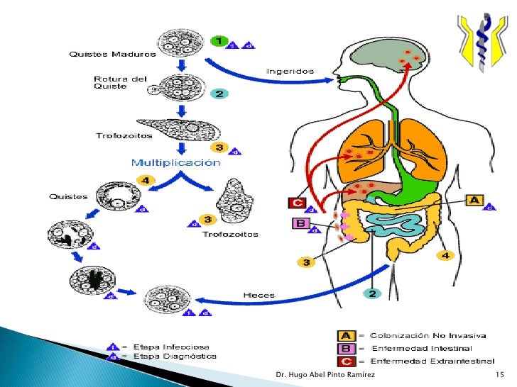 Amebiasis