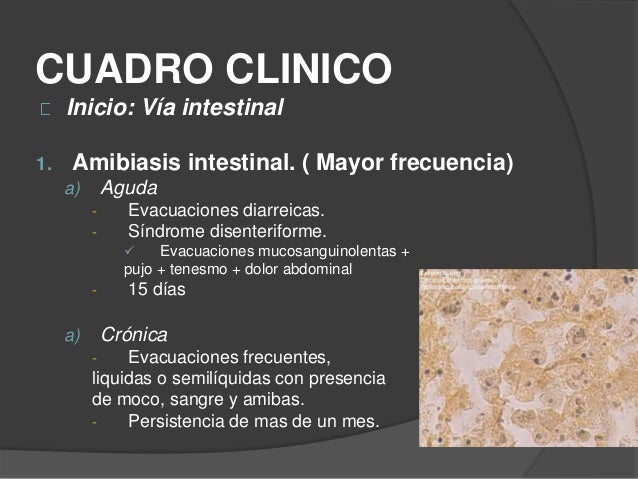 perder grasa abdominal nutriciГіn y dietas Perder grasa abdominal nutriciГіn y dietas Mantenimiento previo