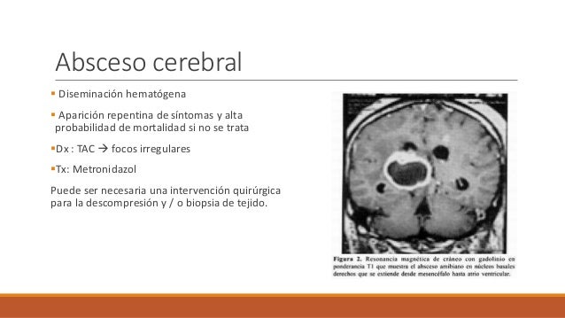 La tuberculosis y el alcoholismo los compendios