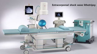 Extracorporeal shock wave lithotripsy
 