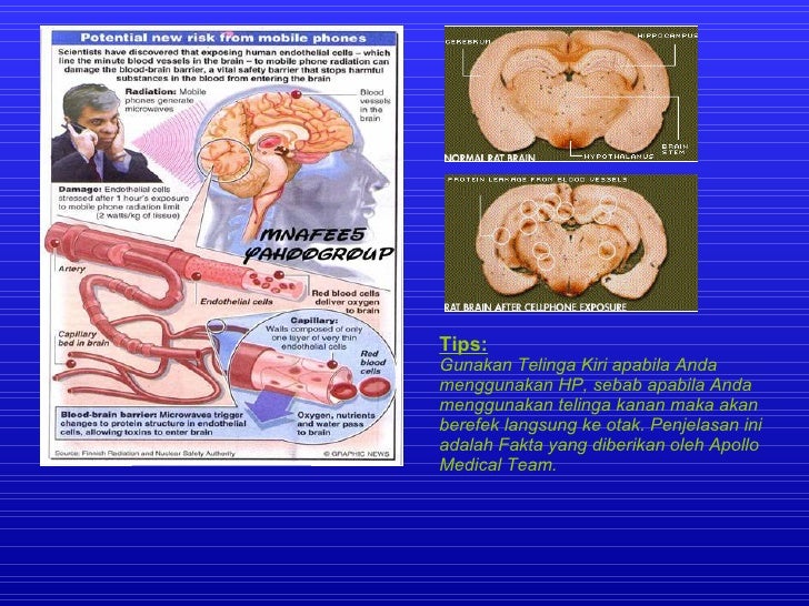 Gelang Magnet:Amega Magnetic+Infra Red Bracelet/ Gelang