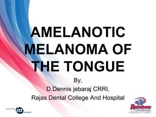 AMELANOTIC
MELANOMA OF
THE TONGUE
By,
D.Dennis jebaraj CRRI,
Rajas Dental College And Hospital
 