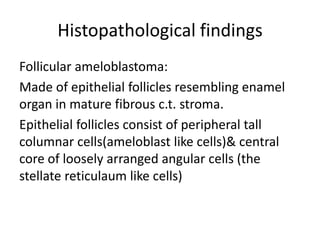Histopathological findings
Follicular ameloblastoma:
Made of epithelial follicles resembling enamel
organ in mature fibrous c.t. stroma.
Epithelial follicles consist of peripheral tall
columnar cells(ameloblast like cells)& central
core of loosely arranged angular cells (the
stellate reticulaum like cells)
 