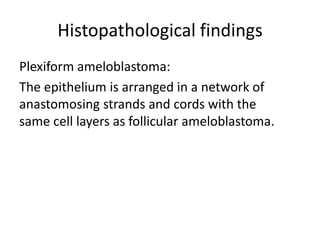 Histopathological findings
Plexiform ameloblastoma:
The epithelium is arranged in a network of
anastomosing strands and cords with the
same cell layers as follicular ameloblastoma.
 