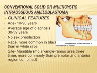 CONVENTIONAL SOLID OR MULTICYSTIC
INTRAOSSEOUS AMELOBLASTOMA
 CLINICAL FEATURES
• Age- 10-90 years
• Average age of diagnosis
30-39 years
• No sex predilection
• Race: more common in blacks
than in white race.
• Site- Mandible (molar-angle-ramus area three
times more commonly than premolar and anterior
region combined)
 