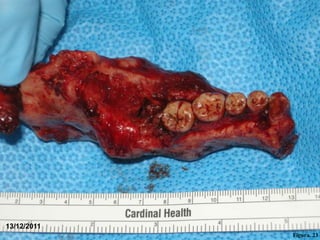 Segmental Section




13/12/2011
                                 Figura. 23
 