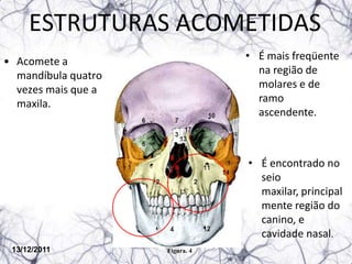 ESTRUTURAS ACOMETIDAS
• Acomete a                      • É mais freqüente
  mandíbula quatro                 na região de
  vezes mais que a                 molares e de
  maxila.                          ramo
                                   ascendente.



                                 • É encontrado no
                                   seio
                                   maxilar, principal
                                   mente região do
                                   canino, e
                                   cavidade nasal.
 13/12/2011          Figura. 4
 