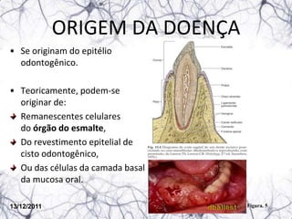 ORIGEM DA DOENÇA
• Se originam do epitélio
  odontogênico.

• Teoricamente, podem-se
  originar de:
  Remanescentes celulares
  do órgão do esmalte,
  Do revestimento epitelial de
  cisto odontogênico,
  Ou das células da camada basal
  da mucosa oral.

13/12/2011                         Figura. 5
 