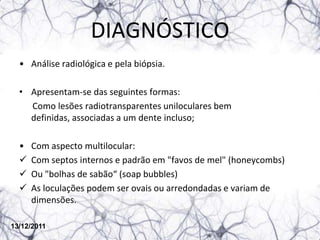 DIAGNÓSTICO
  • Análise radiológica e pela biópsia.

  • Apresentam-se das seguintes formas:
    Como lesões radiotransparentes uniloculares bem
    definidas, associadas a um dente incluso;

  •   Com aspecto multilocular:
     Com septos internos e padrão em "favos de mel" (honeycombs)
     Ou "bolhas de sabão“ (soap bubbles)
     As loculações podem ser ovais ou arredondadas e variam de
      dimensões.

13/12/2011
 