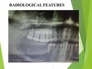 RADIOLOGICAL FEATURES
 