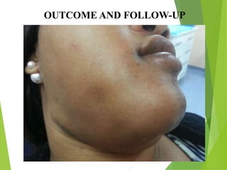 OUTCOME AND FOLLOW-UP
 