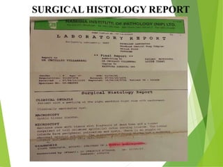 SURGICAL HISTOLOGY REPORT
 