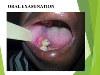 ORAL EXAMINATION
 