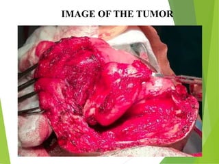 IMAGE OF THE TUMOR
 