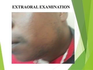 EXTRAORAL EXAMINATION
 