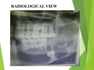 RADIOLOGICAL VIEW
 