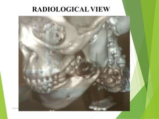 09/30/17
www.stuffamia.com
RADIOLOGICAL VIEW
 