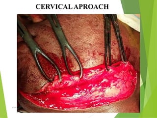 09/30/17
www.stuffamia.com
CERVICALAPROACH
 