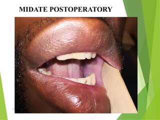09/30/17
www.stuffamia.com
MIDATE POSTOPERATORY
 