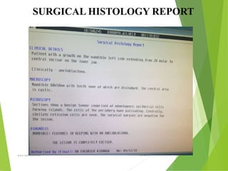 09/30/17
www.stuffamia.com
SURGICAL HISTOLOGY REPORT
 