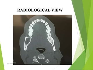 09/30/17
www.stuffamia.com
RADIOLOGICAL VIEW
 
