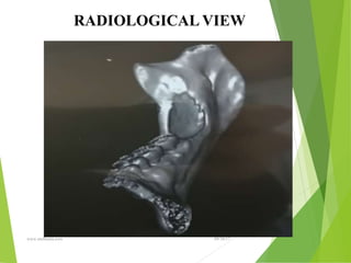 09/30/17
www.stuffamia.com
RADIOLOGICAL VIEW
 