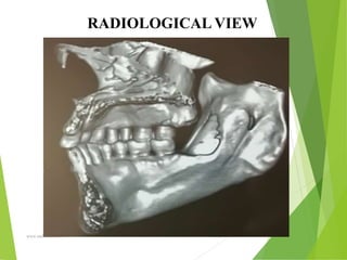 09/30/17
www.stuffamia.com
RADIOLOGICAL VIEW
 