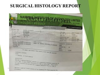 09/30/17
www.stuffamia.com
SURGICAL HISTOLOGY REPORT
 