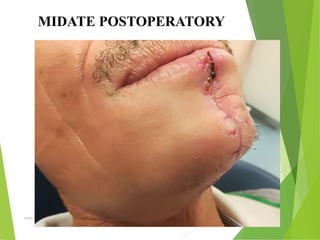 09/30/17
www.stuffamia.com
MIDATE POSTOPERATORY
 