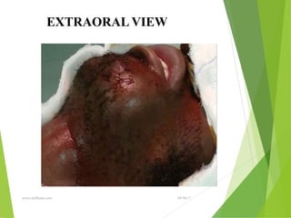 09/30/17
www.stuffamia.com
EXTRAORAL VIEW
 