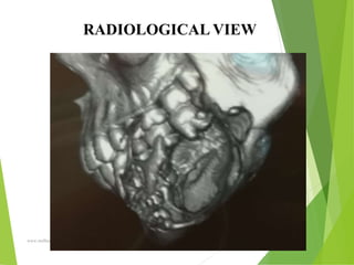 09/30/17
www.stuffamia.com
RADIOLOGICAL VIEW
 