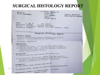 09/30/17
www.stuffamia.com
SURGICAL HISTOLOGY REPORT
 