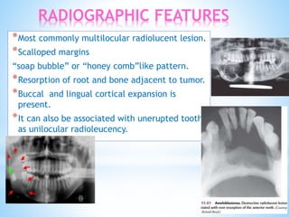ameloblastoma-op-pptx