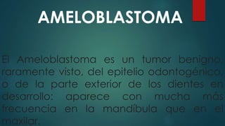 AMELOBLASTOMA
El Ameloblastoma es un tumor benigno,
raramente visto, del epitelio odontogénico,
o de la parte exterior de los dientes en
desarrollo: aparece con mucha más
frecuencia en la mandíbula que en el
maxilar.
 