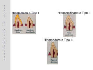 Hipoplásico o Tipo I Hipocalcificado o Tipo II
Hipomaduro o Tipo III
T
I
P
O
S
D
E
A
M
E
L
O
G
É
N
E
S
I
S
 