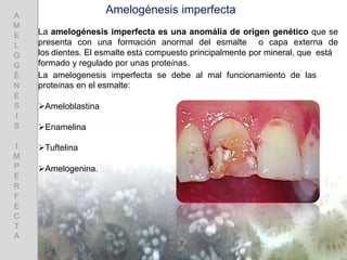 Amelogénesis imperfecta
La amelogénesis imperfecta es una anomálía de origen genético que se
presenta con una formación anormal del esmalte o capa externa de
los dientes. El esmalte está compuesto principalmente por mineral, que está
formado y regulado por unas proteínas.
La amelogenesis imperfecta se debe al mal funcionamiento de las
proteínas en el esmalte:
Ameloblastina
Enamelina
Tuftelina
Amelogenina.
A
M
E
L
O
G
É
N
E
S
I
S
I
M
P
E
R
F
E
C
T
A
 