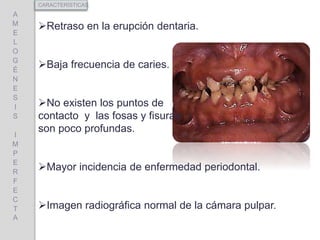 Retraso en la erupción dentaria.
Baja frecuencia de caries.
No existen los puntos de
contacto y las fosas y fisuras
son poco profundas.
Mayor incidencia de enfermedad periodontal.
Imagen radiográfica normal de la cámara pulpar.
A
M
E
L
O
G
É
N
E
S
I
S
I
M
P
E
R
F
E
C
T
A
CARACTERÍSTICAS
 