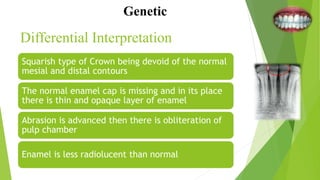 Differential Interpretation
Squarish type of Crown being devoid of the normal
mesial and distal contours
The normal enamel cap is missing and in its place
there is thin and opaque layer of enamel
Abrasion is advanced then there is obliteration of
pulp chamber
Enamel is less radiolucent than normal
Genetic
 