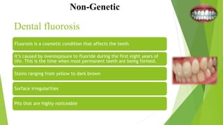 Non-Genetic
Fluorosis is a cosmetic condition that affects the teeth
It’s caused by overexposure to fluoride during the first eight years of
life. This is the time when most permanent teeth are being formed.
Stains ranging from yellow to dark brown
Surface irregularities
Pits that are highly noticeable
Dental fluorosis
 
