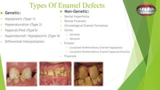 Types Of Enamel Defects
 Genetic:
 Hypoplastic (Type 1)
 Hypomaturation (Type 2)
 Hypocalcified (Type3)
 Hypomatured/ Hypoplactric (Type 4)
 Differential Interpretation
 Non-Genetic:
 Dental Imperfecta
 Dental Fluorosis
 Chronological Enamel Formation
 Caries
 Attrition
 Abrasion
 Erosion
 Localized Nonhereditary Enamel Hypoplasia
 Localized Nonhereditary Enamel Hypocalcification
 Fluorosis
 