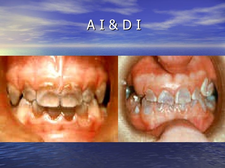 a i