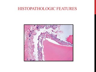 HISTOPATHOLOGIC FEATURES
 