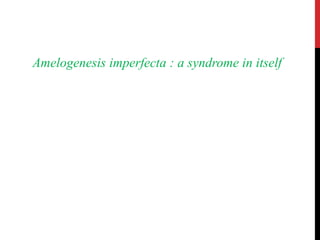 Amelogenesis imperfecta : a syndrome in itself
 